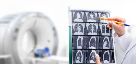 Image of woman holding a CT scan in front of the CAT scan machine.