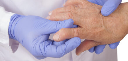rheumatoid arthritis 24-7 medcare
